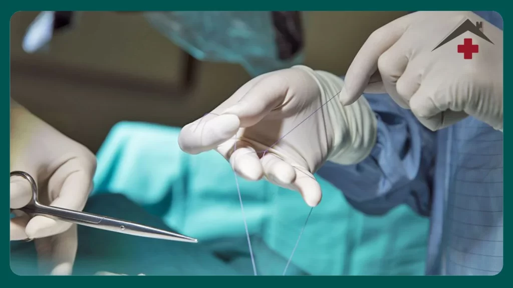 خدمات بخیه و سوچور