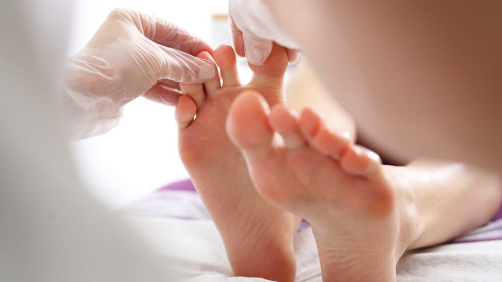 زخم پای دیابتی