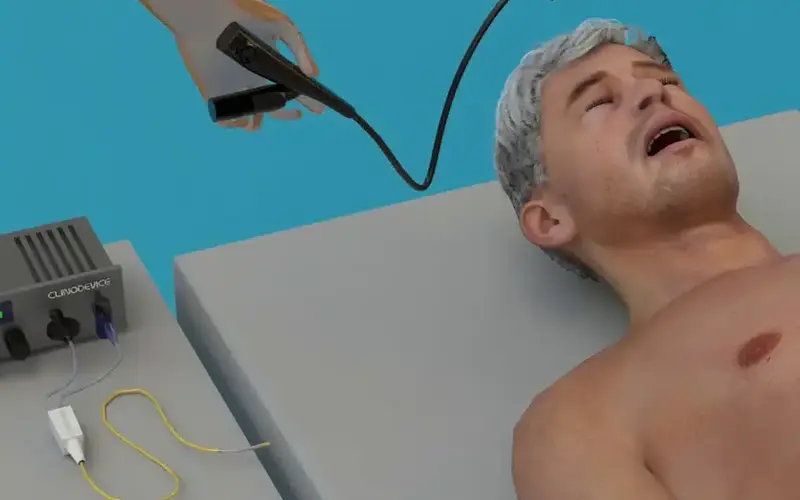 تغذیه بینی به معده