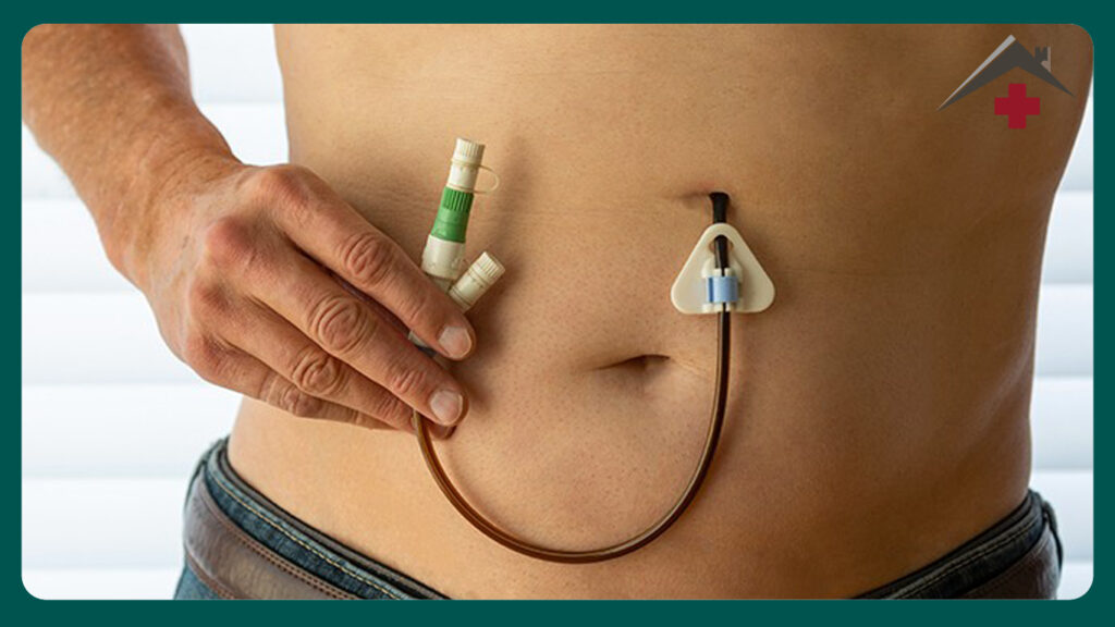 خدمات سوند معده در منزل