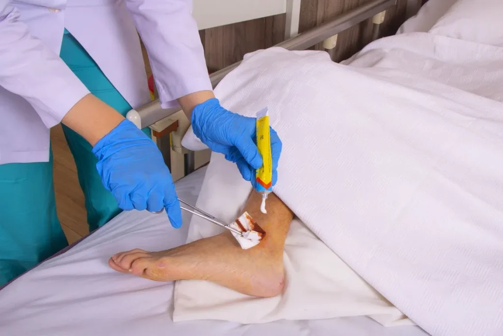 پانسمان زخم در منزل