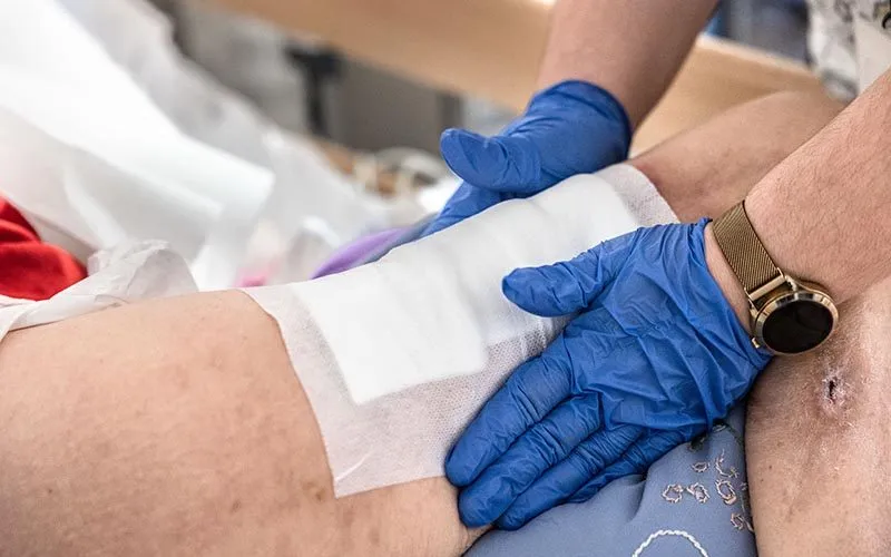 درمان زخم بستر سالمندان