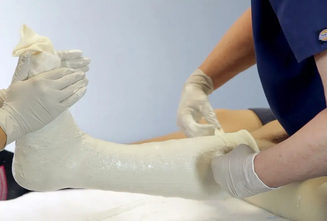 گچ گرفتن و باز کردن گچ در منزل