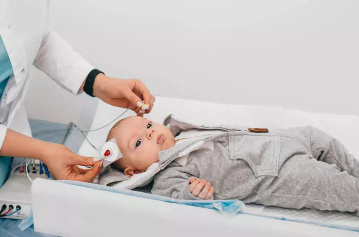 تست شنوایی نوزادان