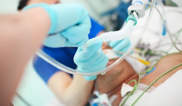 ساکشن ریه در منزل