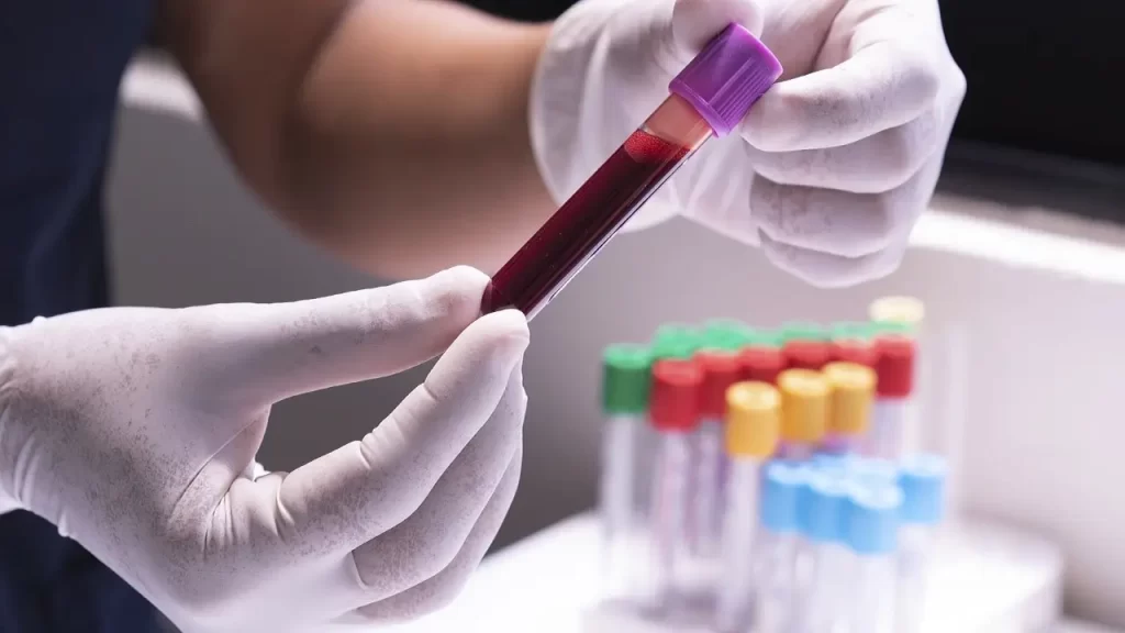 انواع آزمایش در منزل